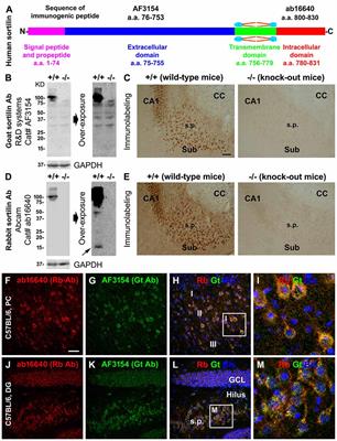 Sortilin Fragments Deposit at Senile Plaques in Human <mark class="highlighted">Cerebrum</mark>